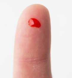 採手臂血和手指血有什麼區別，不僅為了方便，有些人採指頭血最好